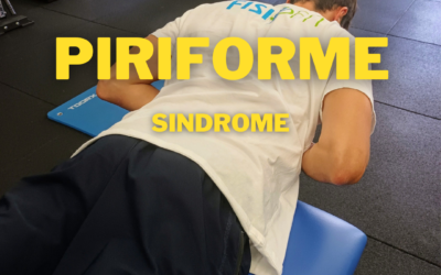 Sindrome del piriforme