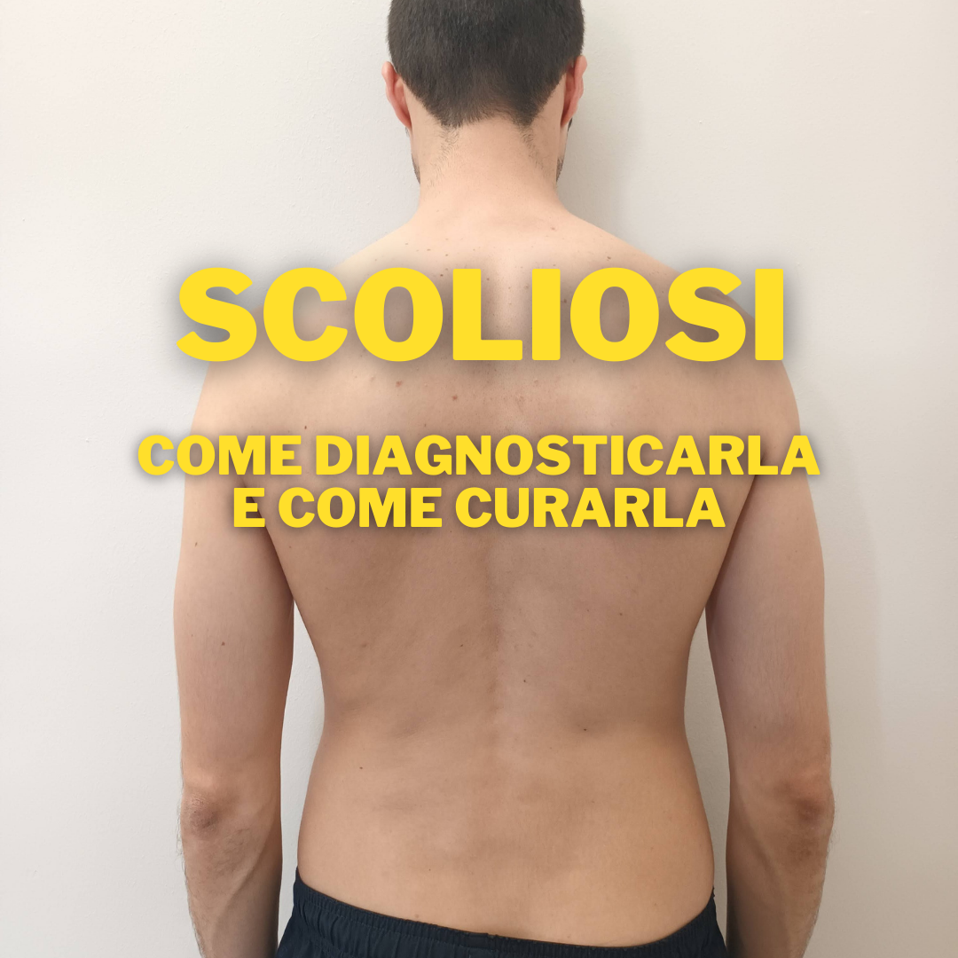 scoliosi_fisioterapia_piacenza